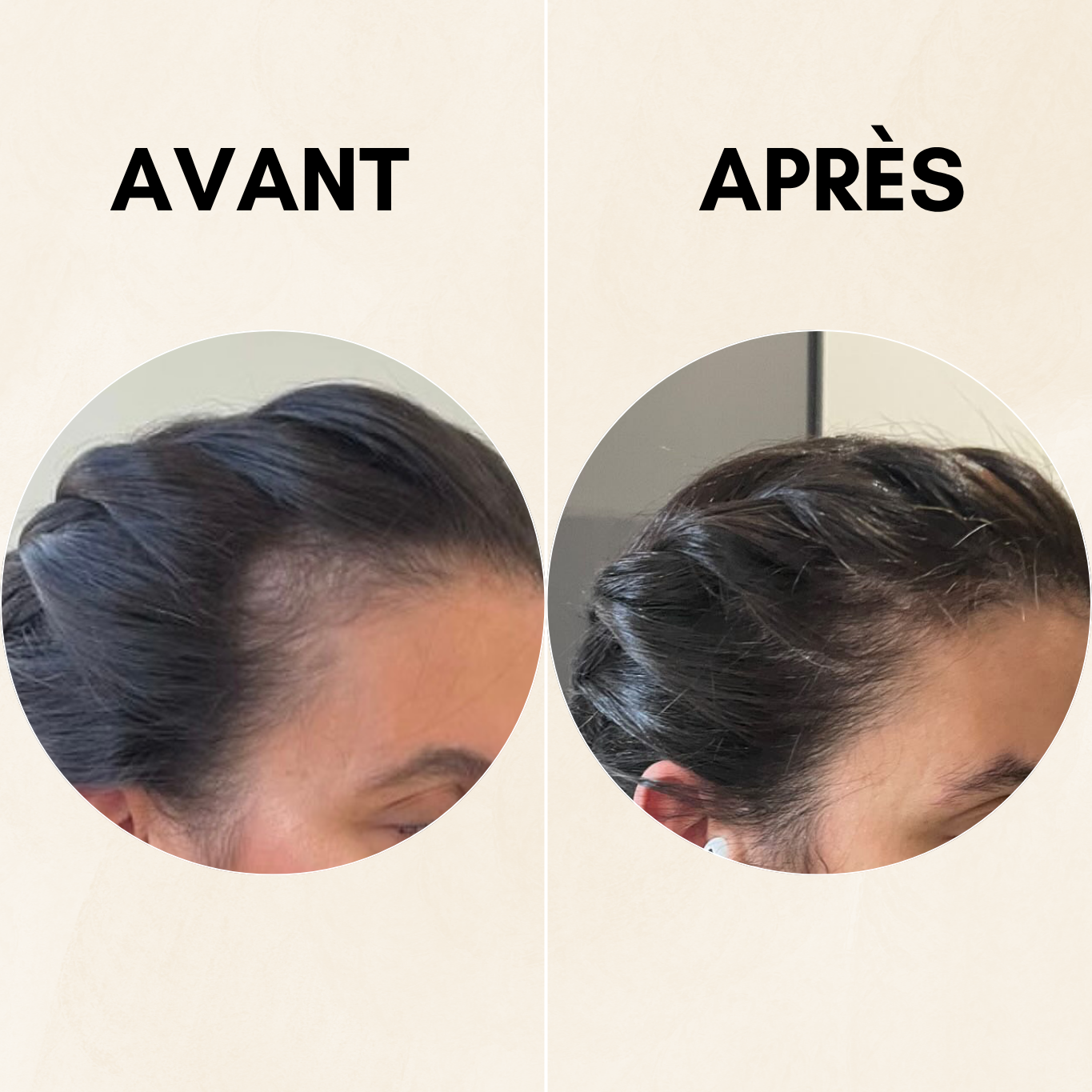 Pack complet anti-chute