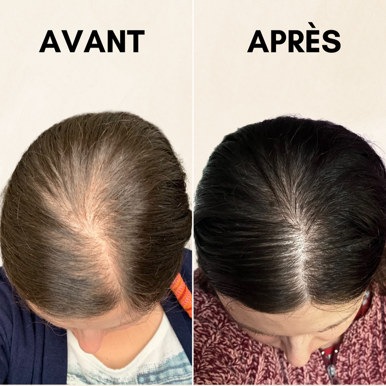 Compléments alimentaires anti-chute