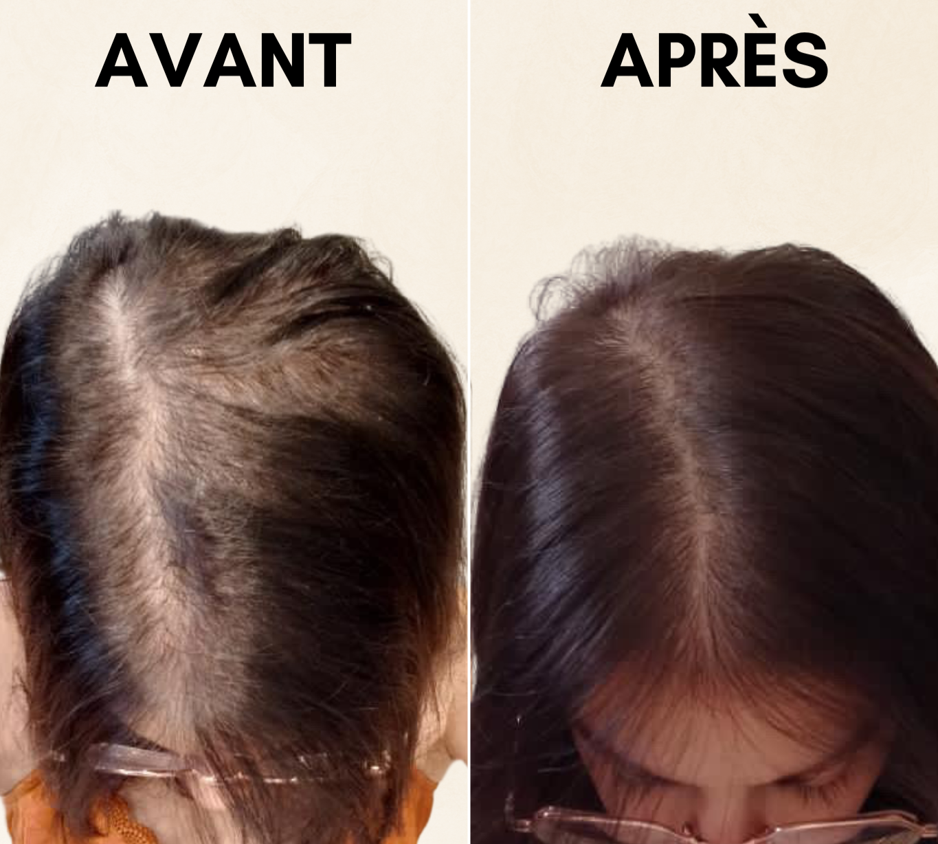 AVANT_APRES_NL_SENS.png