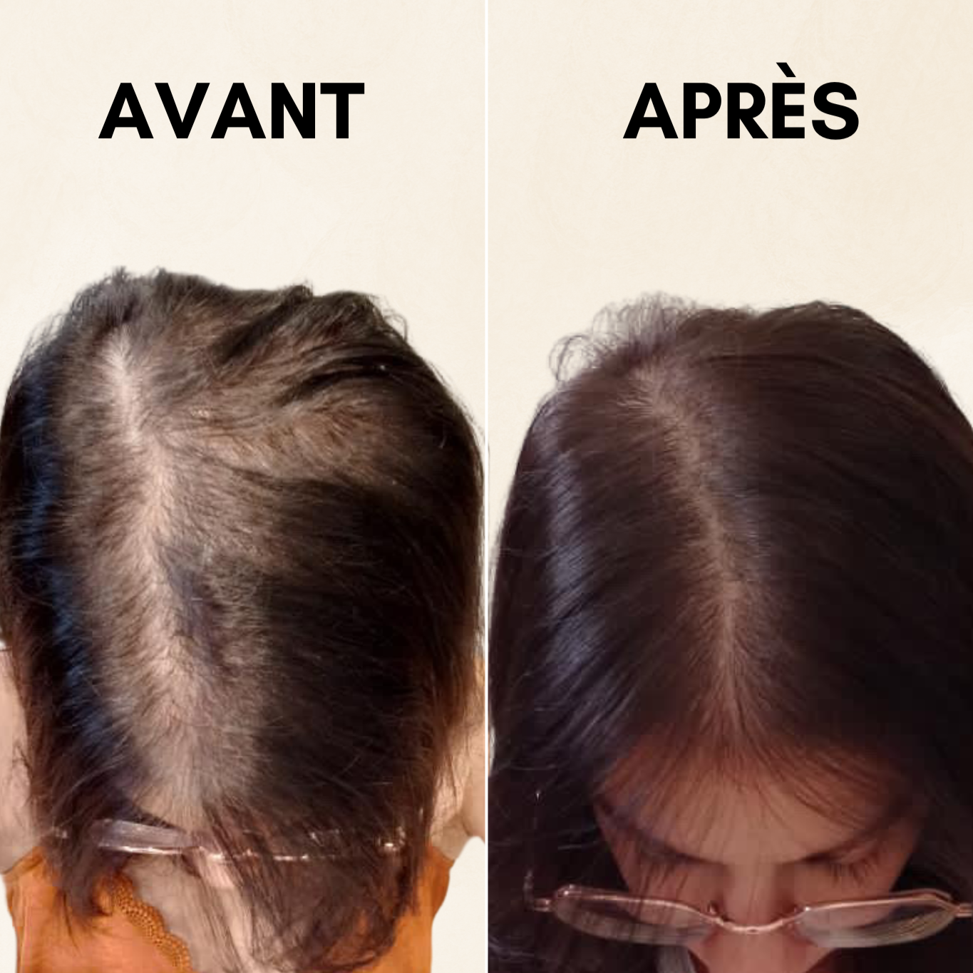 Compléments alimentaires anti-chute