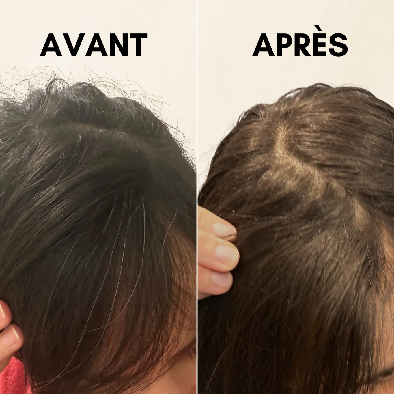 Compléments alimentaires cheveux blancs